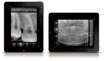 デジタルパノラマレントゲンPanoACT-1000、PanoACT ART Plusシリーズ